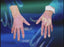 Hand Injuries - Gory Story (Waste Management)